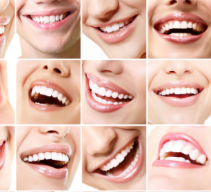 冷光牙齿美白仪加盟和其他保健加盟品牌有哪些区别？冷光牙齿美白仪品牌优势在哪里？